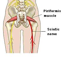 sciatic nerve position