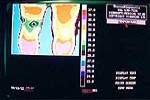 knee pain muscle spasms