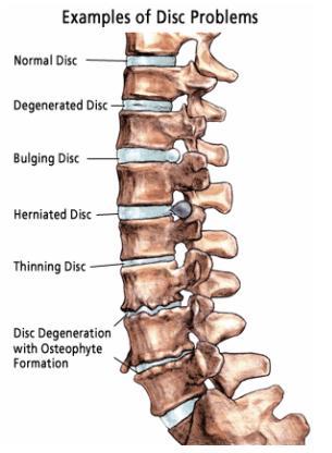 examples of disc problems