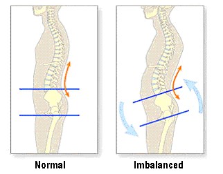 muscle imbalance