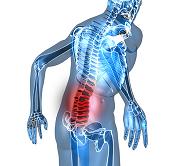 low back pain causes